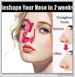 Wanda's Electric Nose Lifter - Premium device for natural nose reshaping without surgery
