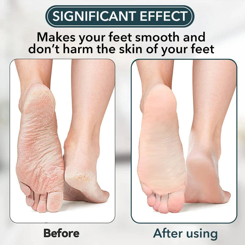 Premium Nano-Glass Foot File for Removing Dead Skin and Calluses, Leaving Feet Smooth and Rejuvenated