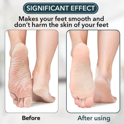Premium Nano-Glass Foot File for Removing Dead Skin and Calluses, Leaving Feet Smooth and Rejuvenated