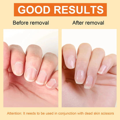 Premium 15ml cuticle softener and moisturiser for hand and foot nail care, softens and hydrates dry, brittle nails