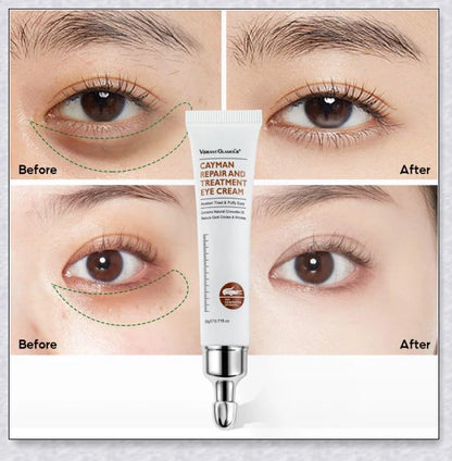 Magic Eye Cream that instantly reduces bags, dark circles, and wrinkles in 28 seconds for radiant, youthful-looking eyes