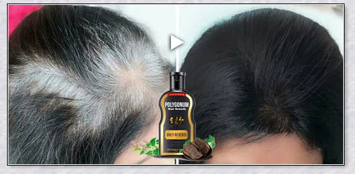 Grey Reverse Hair Colour Shampoo that restores natural hair pigment and promotes healthy hair growth