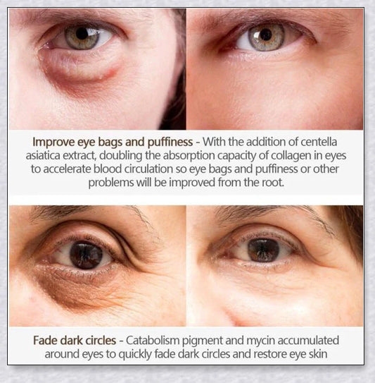 Magic Eye Cream that instantly reduces bags, dark circles, and wrinkles in 28 seconds for radiant, youthful-looking eyes