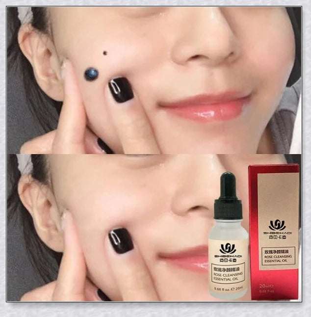 Premium organic skin tag removal serum with natural botanical ingredients for effective, gentle skin rejuvenation
