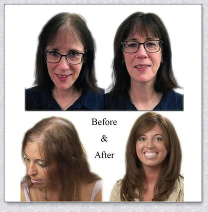 Volumising Hair Topper Clip for Women - Instantly Add Volume and Coverage to Your Hair