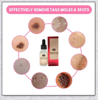 Premium organic skin tag removal serum with natural botanical ingredients for effective, gentle skin rejuvenation