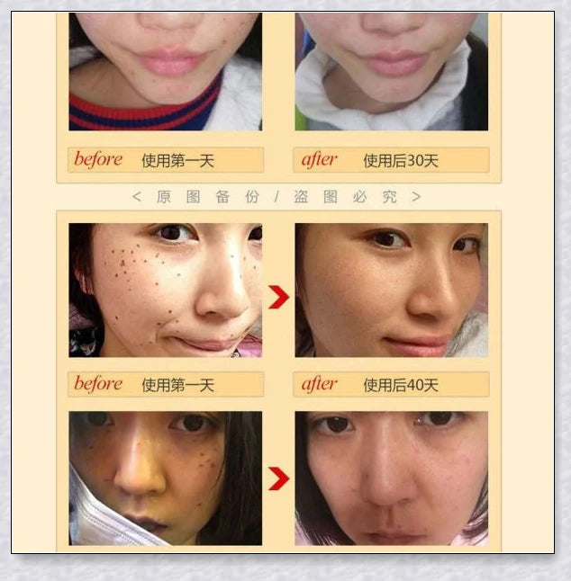 Premium organic skin tag removal serum with natural botanical ingredients for effective, gentle skin rejuvenation