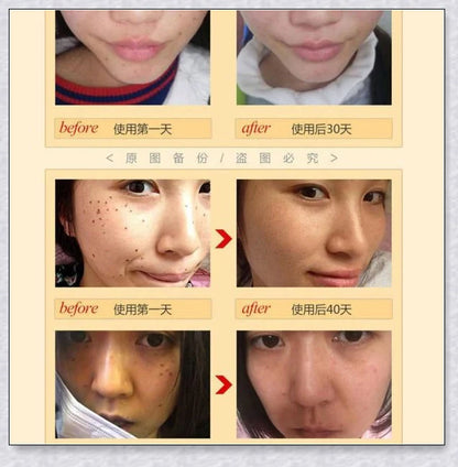 Premium organic skin tag removal serum with natural botanical ingredients for effective, gentle skin rejuvenation
