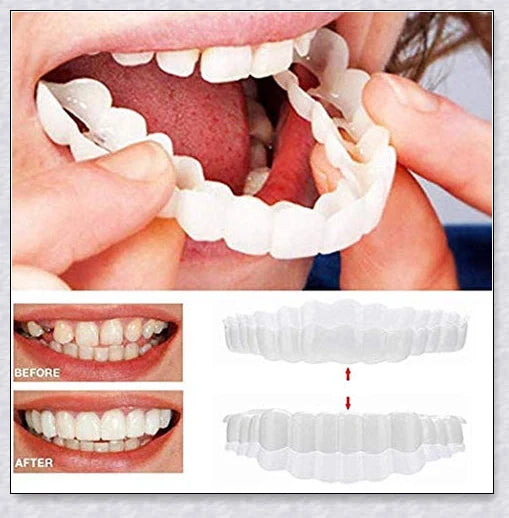 Premium snap-on veneers made with micro-thin polypropylene to instantly transform your smile