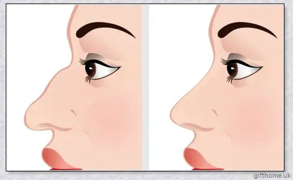Wanda's Electric Nose Lifter - Premium device for natural nose reshaping without surgery