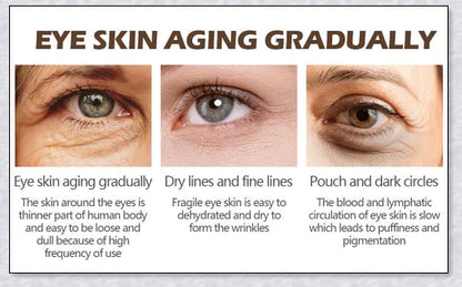 Magic Eye Cream that instantly reduces bags, dark circles, and wrinkles in 28 seconds for radiant, youthful-looking eyes