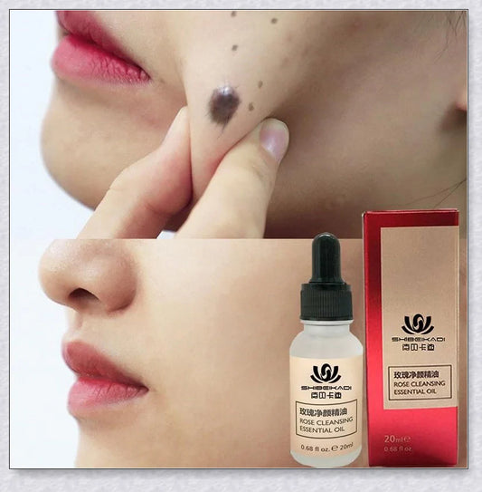 Premium organic skin tag removal serum with natural botanical ingredients for effective, gentle skin rejuvenation