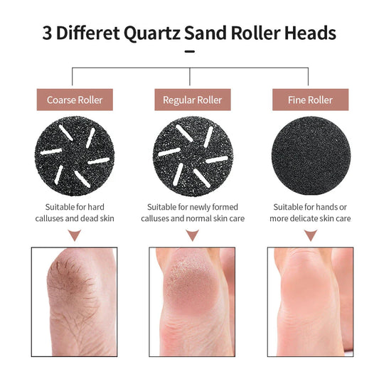 Electric Foot Dead Skin Remover, foot exfoliator with rechargeable battery and ergonomic design for smooth, soft feet