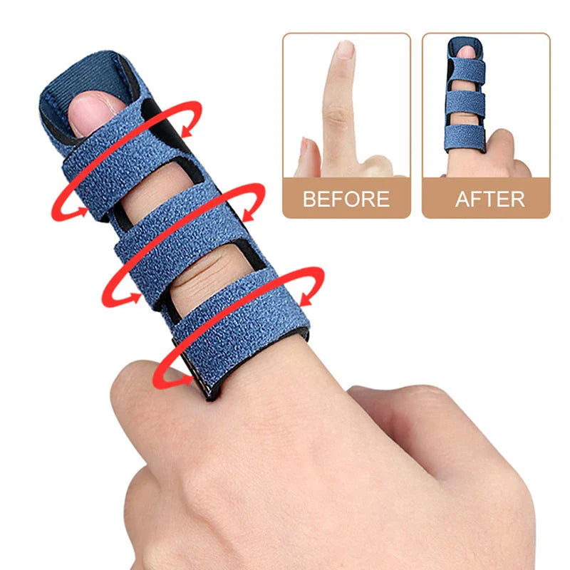 Premium Adjustable Finger Splint with Detachable Aluminium Bar for Customisable Support and Protection